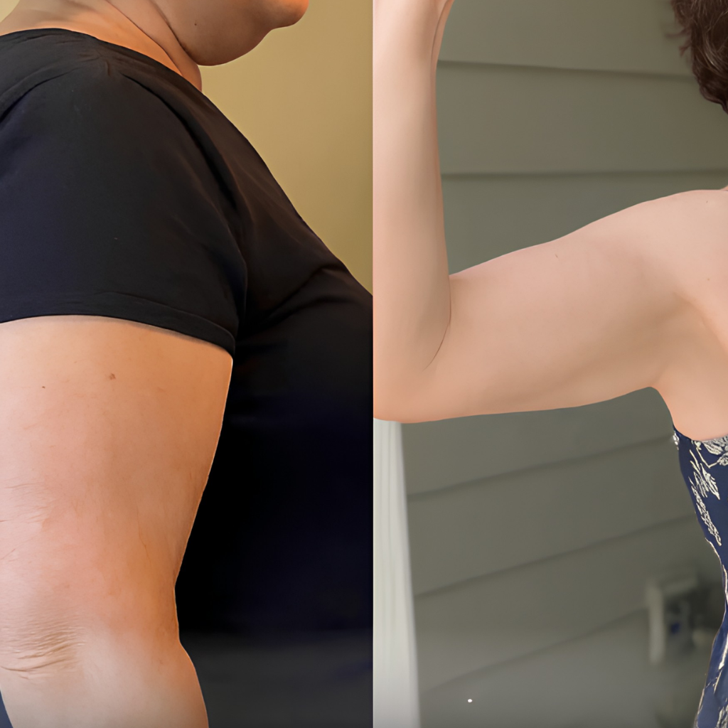 Efekt ćwiczeń z ArmFlow — Kasia